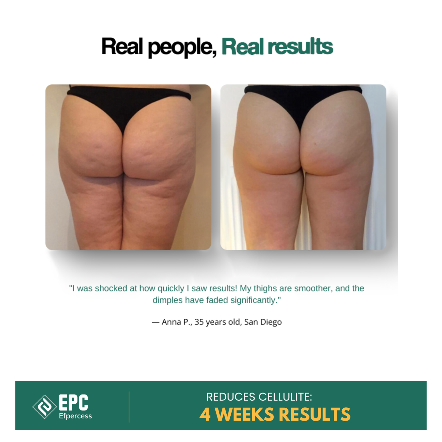 Efpercess™ RevivePro 12-Level Cupping & Cellulite Massager