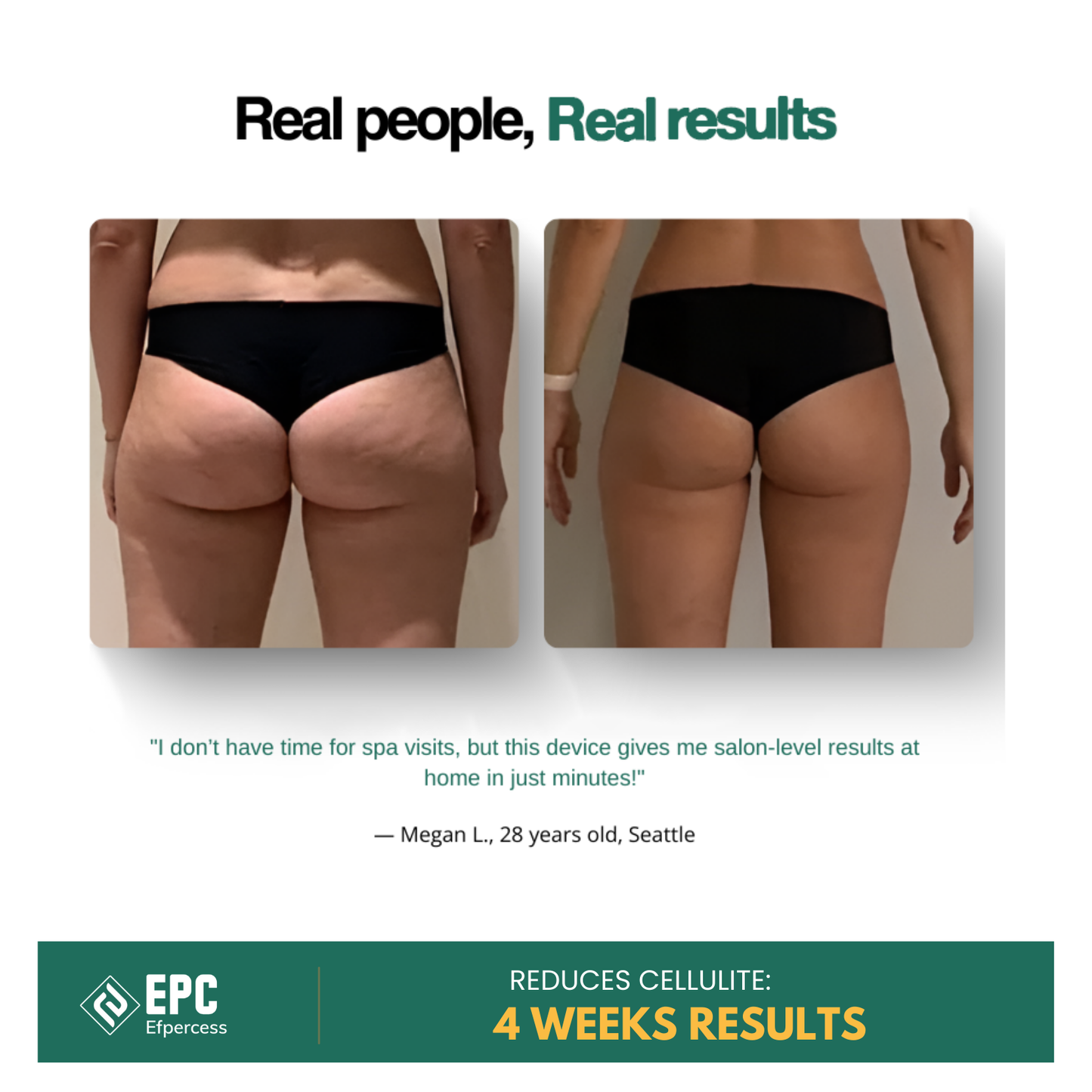 Efpercess™ RevivePro 12-Level Cupping & Cellulite Massager