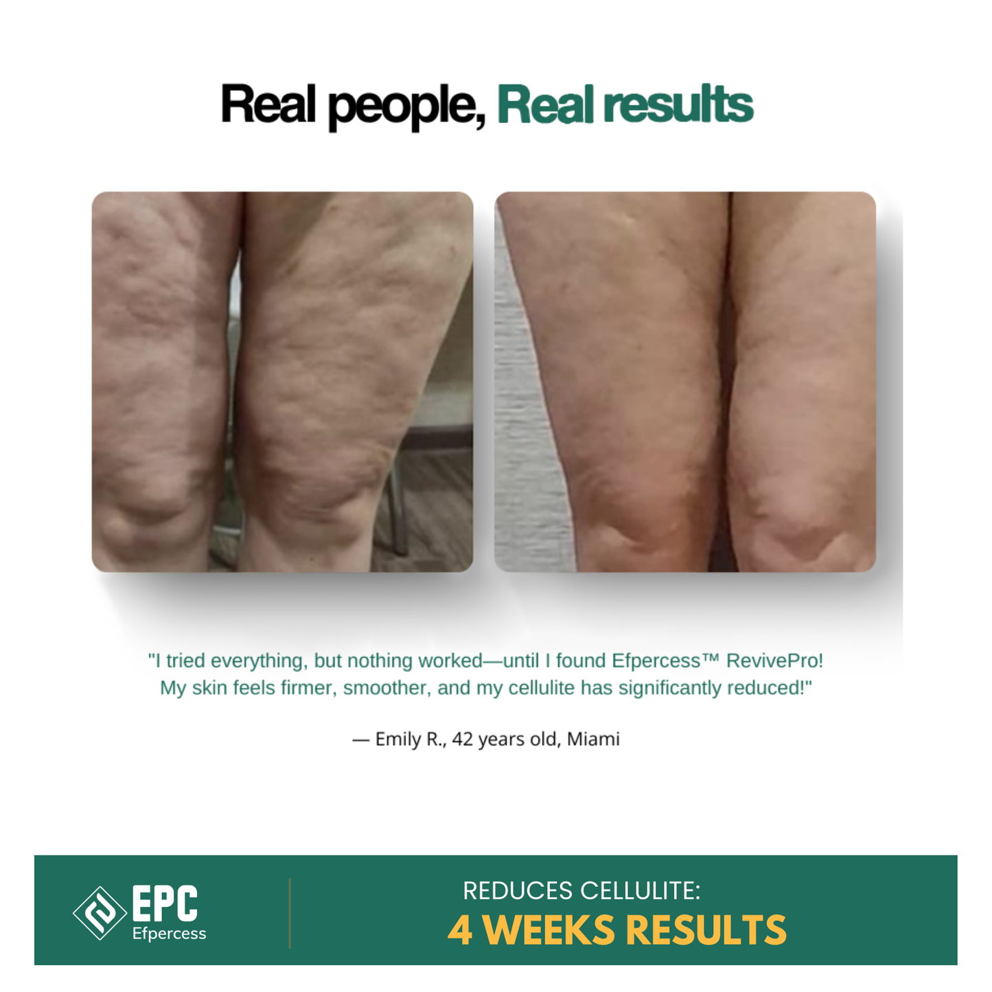 Efpercess™ RevivePro 12-Level Cupping & Cellulite Massager