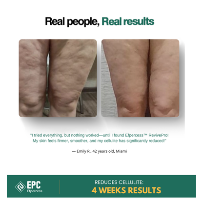 Efpercess™ RevivePro 12-Level Cupping & Cellulite Massager