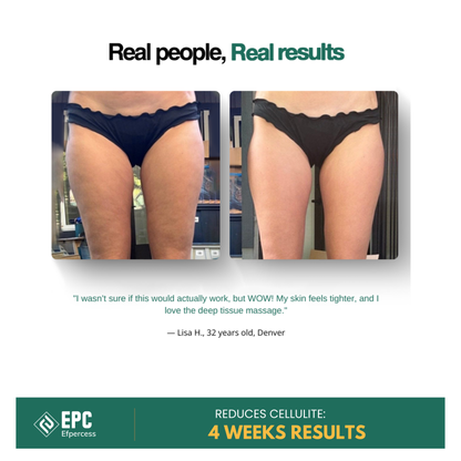 Efpercess™ RevivePro 12-Level Cupping & Cellulite Massager