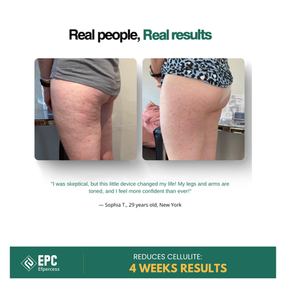 Efpercess™ RevivePro 12-Level Cupping & Cellulite Massager